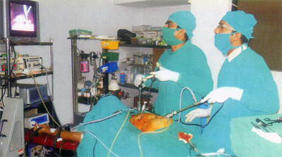 Stryker HD - Laparoscope